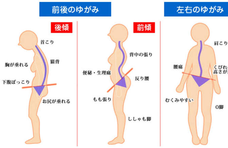 背骨矯正・骨盤矯正を行い長年の症状を改善させます👨‍⚕️｜曽於市・都城市の整体なら整体院Re.make-リメイク-