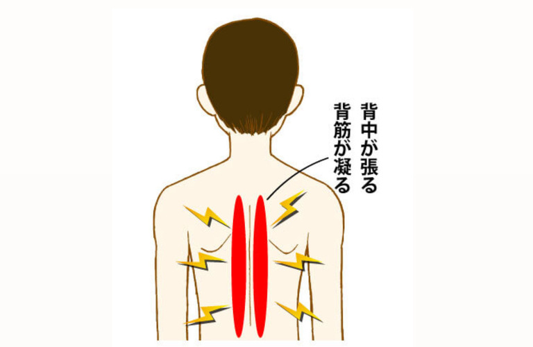 最近、背中の張りや痛みでお越し下さる方が多いです！｜曽於市・都城市の整体なら整体院Re.make-リメイク-